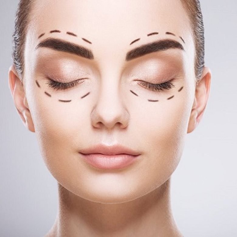 Faqs-About-Eyelid-Surgery