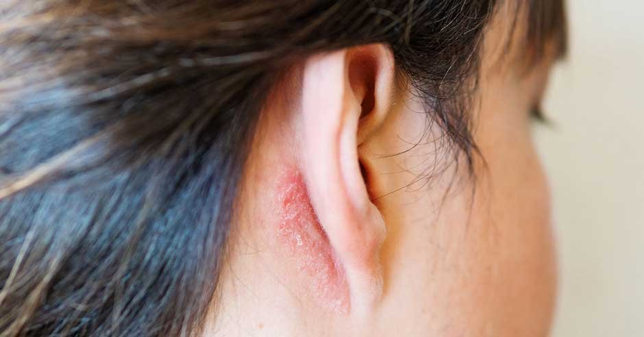 Signs of Ear Infection Due to Allergies