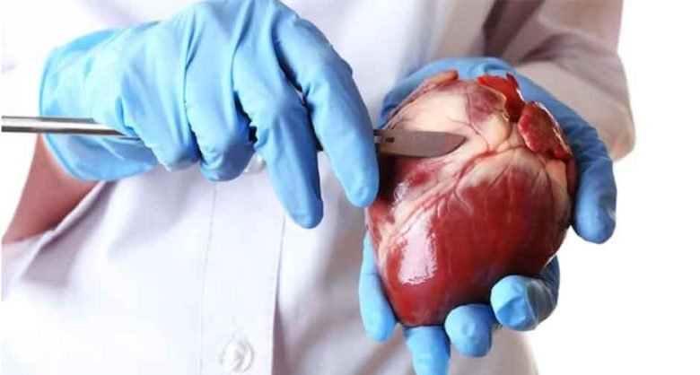 Understand the Procedure, Risks, and Benefits of Aortic Valve Replacement1