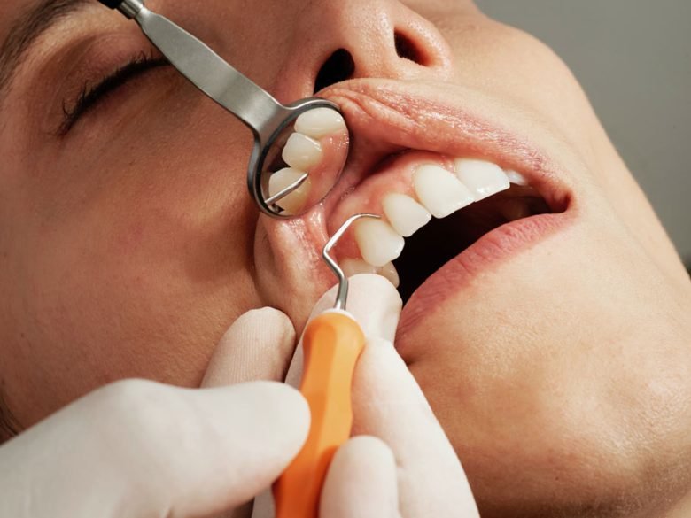 5 Common Myths About Oral Health, Debunked by a Dentist