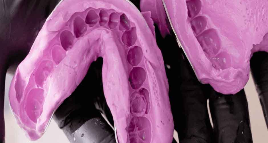 Navigating-Dental-Molding-Techniques