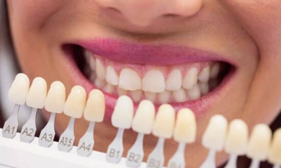 Smile Makeover Magic