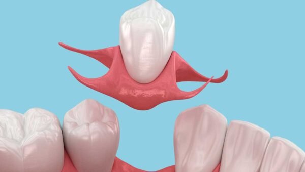 Fixed-vs.-Removable-Choosing-the-Best-Solution-to-Replace-Your-Missing-Tooth